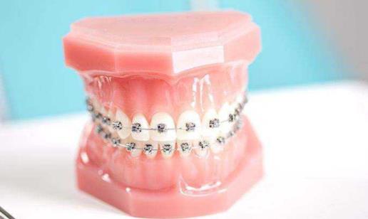 兒童牙齒矯正的最佳年齡 兒童牙齒矯正的方法有哪些