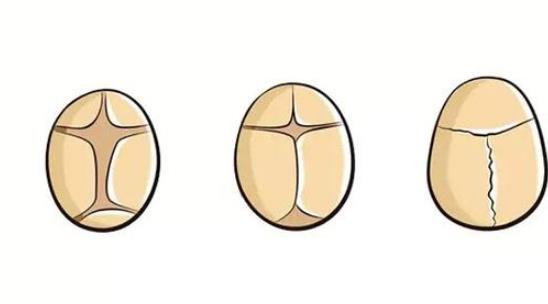 囟門閉合時間是什么時候比較好 囟門閉合最佳時間