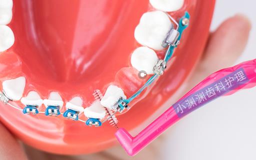 牙齒矯正最佳年齡是什么時候 牙齒什么時候矯正好