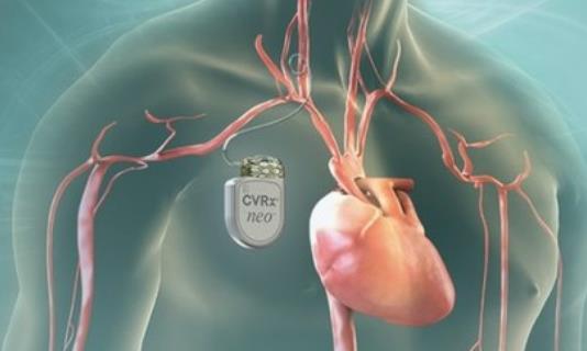 高血壓病人最佳運動時間 高血壓病人什么時候運動好