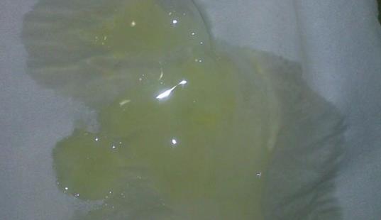 白帶一般是什么時候來 白帶是什么時候才會有