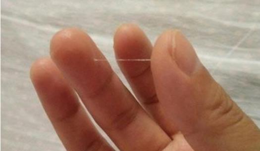 白帶一般是什么時候來 白帶是什么時候才會有