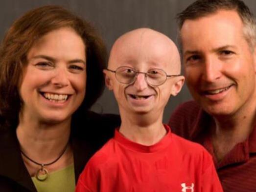 世界上十大必死病排名,狂犬病、晚期癌癥死亡率非常高