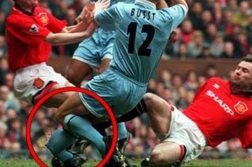 世界足壇十大斷腿事件 世界足壇最恐怖的斷腿事件 足壇斷腿事件盤點