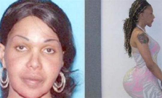 世界十大最瘋狂的整形手術排名 男子布賴恩隆出38C胸