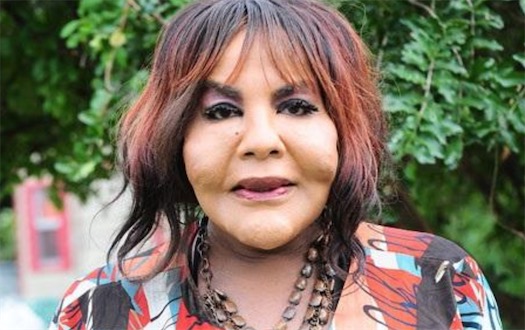 世界十大最瘋狂的整形手術排名 男子布賴恩隆出38C胸