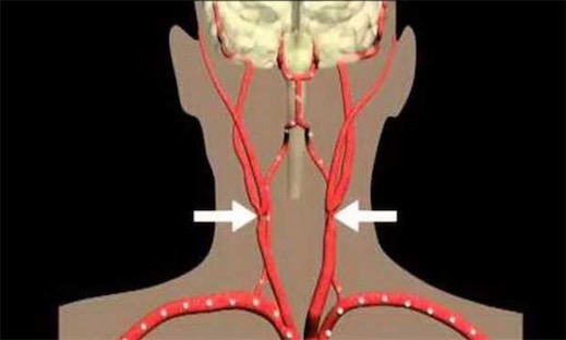 古代十大止痛方法排名 排名第一的居然是罌粟