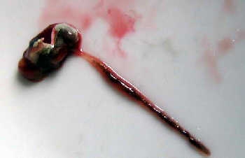 �����r��ϴ����