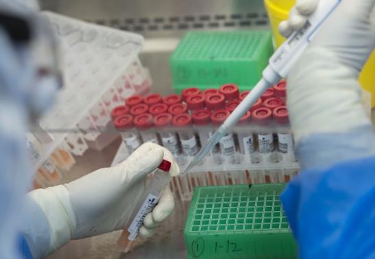 核酸檢測后會有嚴重反應嗎?核酸檢測出結果那天算有效期內嗎