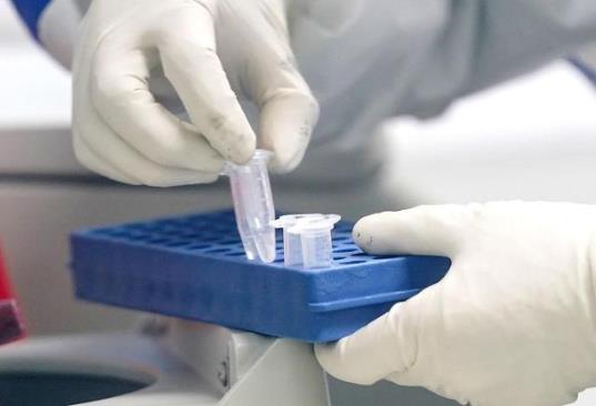 醫(yī)院打印核酸報(bào)告要錢嗎?核酸檢測可以去別的省做嗎?