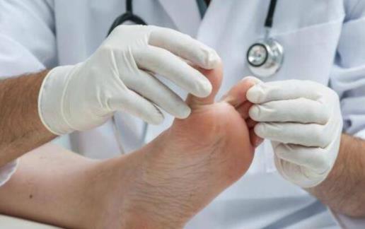 腳氣是身體在排毒嗎 腳氣會通過鞋子傳染嗎