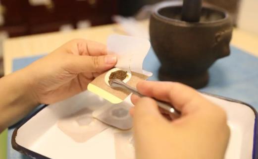 三九貼可以一直貼著嗎 三九貼一共貼幾個位置