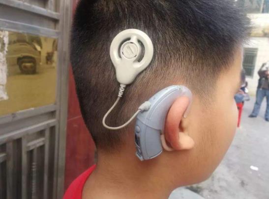 小孩子做了人工耳蝸后會有哪些不便?人工耳蝸聽力能達到多少分貝