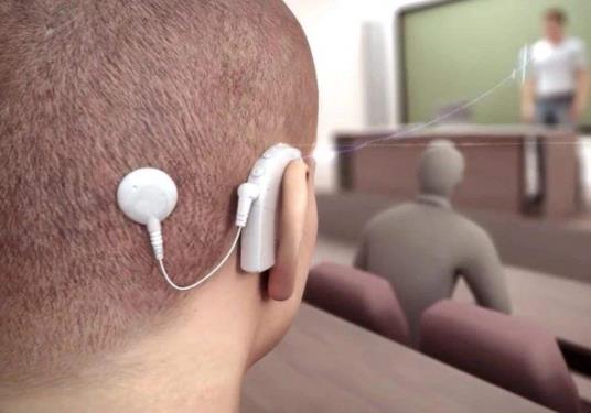 小孩子做了人工耳蝸后會有哪些不便?人工耳蝸聽力能達到多少分貝