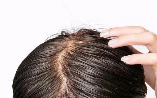 頭發(fā)淋雨不洗會長虱子嗎 淋雨后一定要洗頭嗎不洗會怎樣