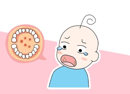 皰疹性咽峽炎是什么?皰疹性咽峽炎不能吃什么