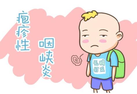 皰疹性咽峽炎是什么?皰疹性咽峽炎不能吃什么