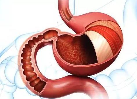 胃竇炎的癥狀是什么?胃竇炎不能吃什么