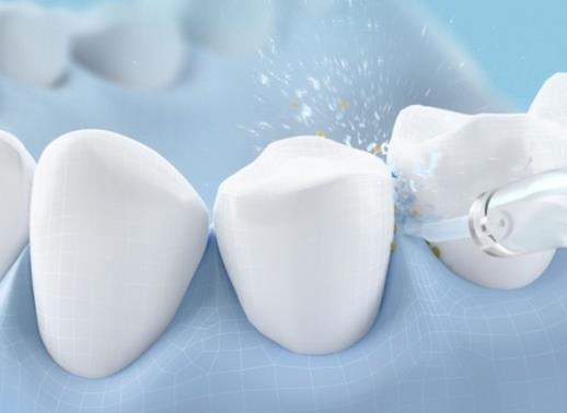 沖牙器的水裝一次能用多久?沖牙器的使用壽命是多長?