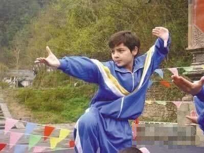 禿然長大是什么意思?童星阿爾法19歲謝頂21歲植發成功分享經歷