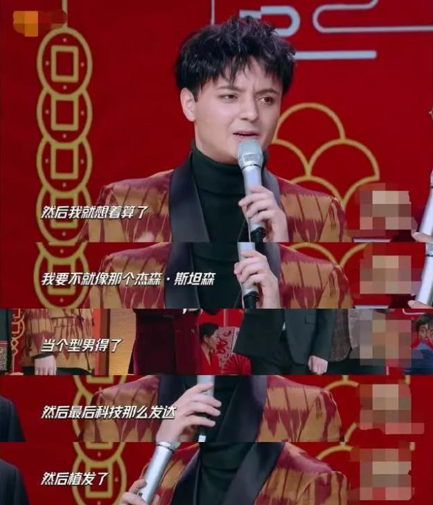 禿然長大是什么意思?童星阿爾法19歲謝頂21歲植發成功分享經歷