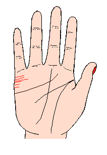 結合線很短又不規則,而且很多條