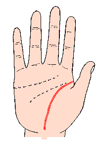 生命線圖解：生命線成為鏈狀