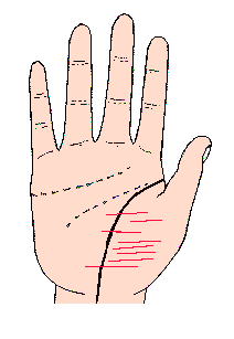 金星丘附近的折線，橫過生命線
