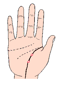 生命線的中途，出現島形記號