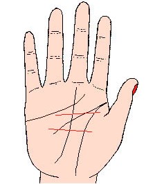 障礙線圖解:手相障礙線算命圖解