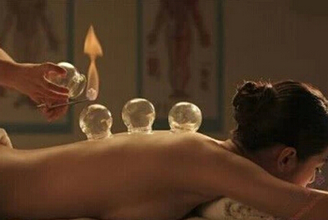 拔火罐能減肥嗎?拔火罐減肥的壞處