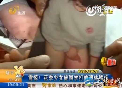 16歲花季少女被四名室友毆打4小時,脫光了跪在地上打,打得遍體鱗傷