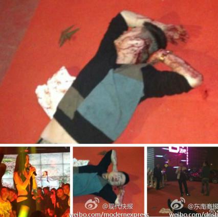 干露露宜興酒吧違規(guī)走穴又惹亂子，男子拉扯干露露被群毆(圖)