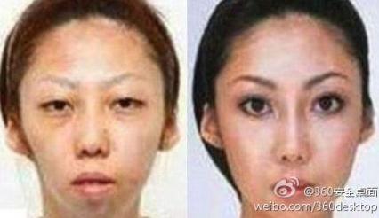 【老婆太丑】老婆漂亮女兒太丑，男子告整容老婆獲賠75萬，是整容醫院炒作嗎