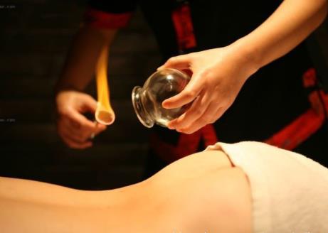 拔火罐的好處:背部拔罐有什么好處