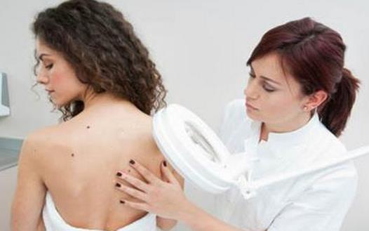 了解皮膚癌的早期癥狀 正確治療預防皮膚癌