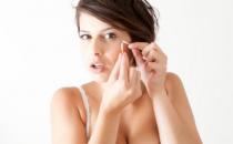 痘痘為什么老是長在同一個地方？