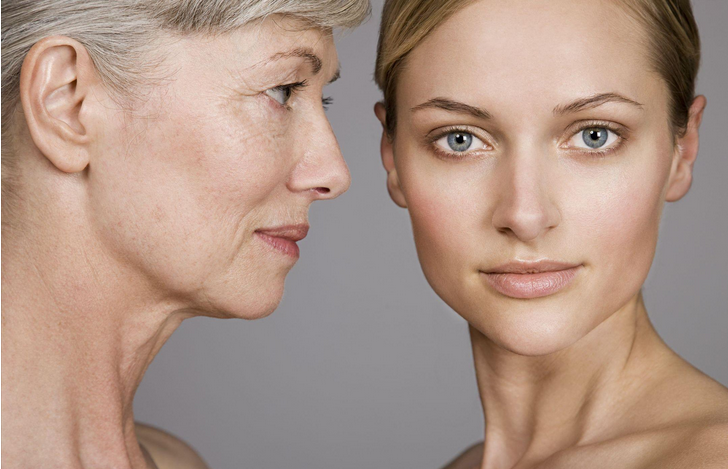 電波拉皮去除魚尾紋的效果