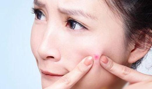 秋燥上火“爆痘”,虛實要分清