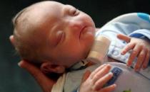 沒有鼻子的嬰兒，媽媽說他是完美的