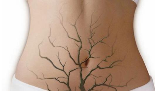 哪些不良習(xí)慣會(huì)導(dǎo)致便秘