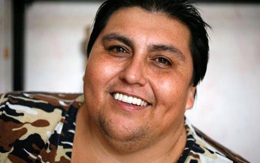 肥胖的原因及預防方法