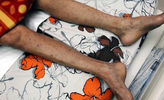 和室友同床染艾滋 男人如何預防艾滋病