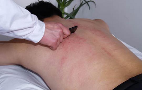 刮痧治療早泄嗎 刮痧的注意事項