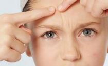 盤(pán)點(diǎn)易長(zhǎng)痘痘的日常用品