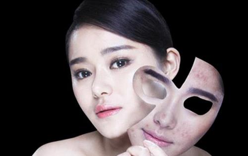 七個小竅門幫你戰(zhàn)勝痘痘