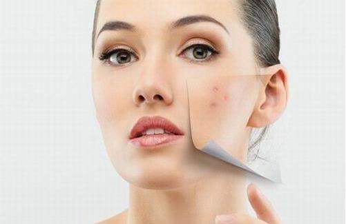 學會這七招解決痘痘問題