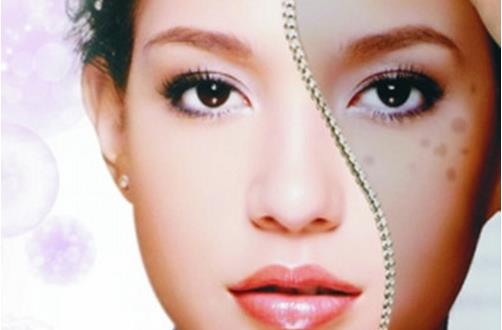 好習(xí)慣能幫忙掃除色斑