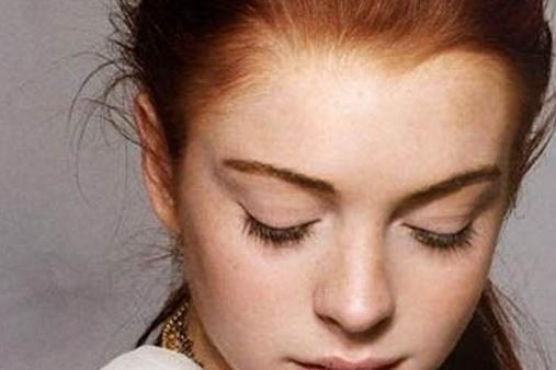 祛斑失敗的原因有哪些 如何應對