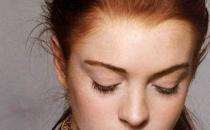 祛斑失敗的原因有哪些 如何應(yīng)對